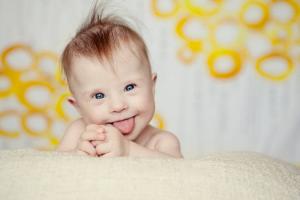 12 egenskaper hos barn med Downs syndrom