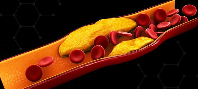 Kolesterol - kolesterol