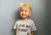 Maskrosbarn: Vad är hårfritt syndrom?
