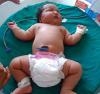 6 till 8 kg: de största nyfödda i världen