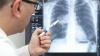 Läkare jämför strålningsexponering med CT av lungor med strålning i Hiroshima