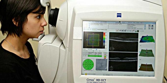 Optisk koherens tomografi angiografi