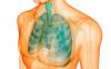 Lungsjukdom som kryper upp obemärkt
