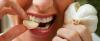 7 sätt hur man kan bli av med lukten av vitlök mun