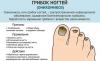 Hur man kan bli av svampinfektion på naglarna