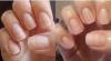 Hur återställa naglarna efter en uppbyggnad, samt att stärka nagelplattan