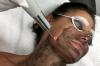 Laser kol peeling: några problem hud tillför den ideala