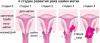 7 tecken på livmoderhalscancer, där kvinnor ofta ignorerar