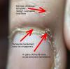 Varför är det viktigt att lära sig regelbundet trycka tillbaka nagelbanden själv