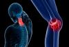 5 tecken på att du har osteoporos startar